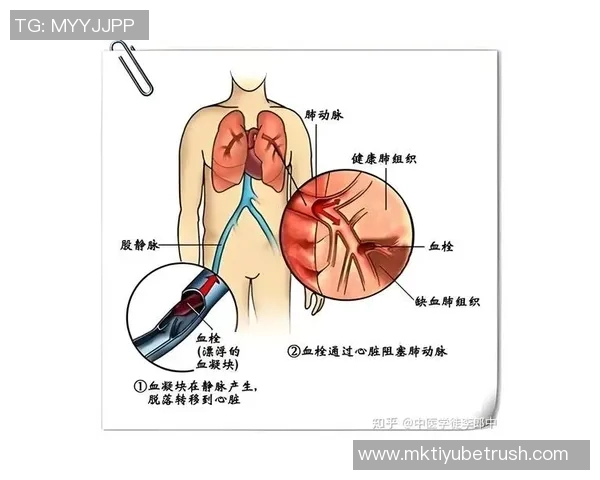 文班谈血栓伤病的医学分析与心理状态的积极应对